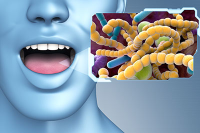 The image features a 3D rendering of a human face with an open mouth, overlaid with a graphic of bacterial cells labeled  Bacteria.