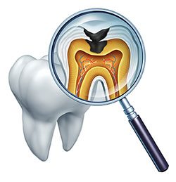 The image shows a magnified view of a dental tooth with an open crown, revealing the internal structure including the pulp chamber and root canals, under a microscope with a focus on the tooth s interior.