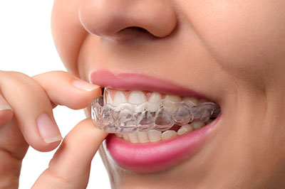 An adult woman with a smile showing her clear braces and teeth, holding a finger close to her mouth.